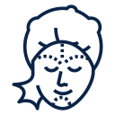 Chemical Peels