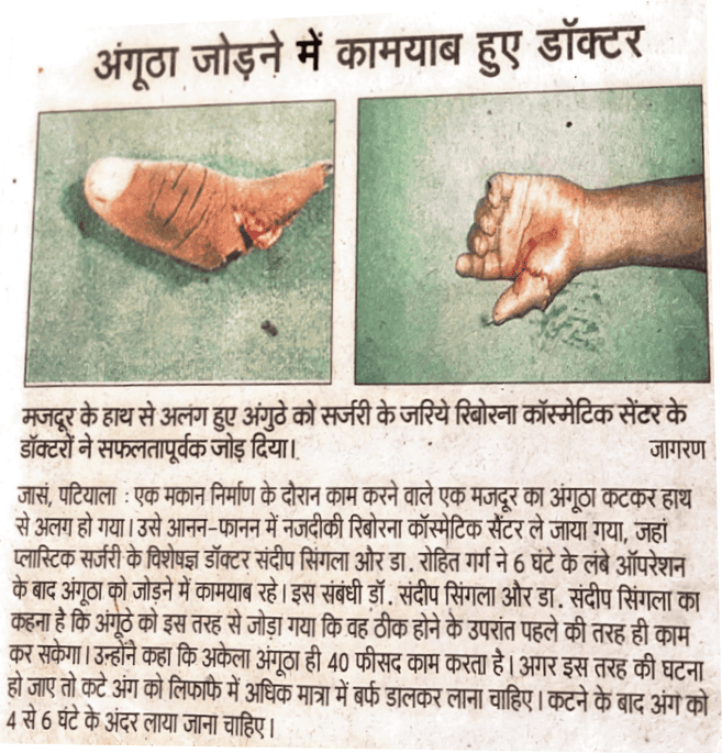 thumb surgery paper cutting